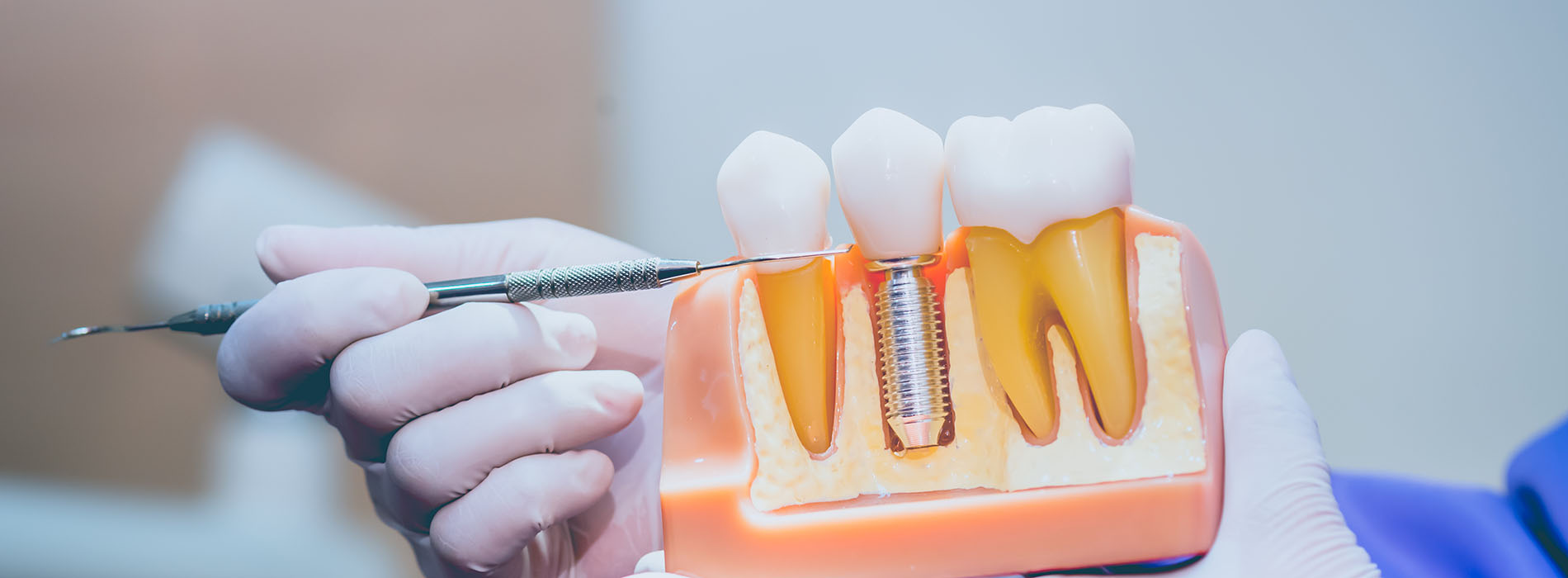 Mark Studer, DDS  | Dental Fillings, Oral Exams and Dental Cleanings